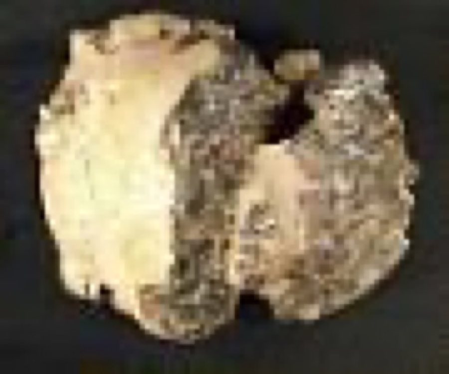 Pachycephalosaurus wyomingensis — Pachycephalosaurus wyomingensis Gilmore, 1931